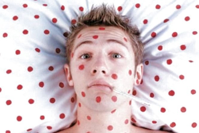 Кір не відступає — зробіть щеплення дитині до початку навчального року Кір не відступає — зробіть щеплення дитині до початку навчального року